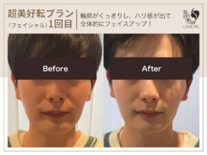 フェイシャルの施術ビフォーアフター 78