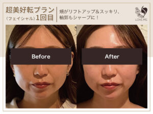 フェイシャルの施術ビフォーアフター 9